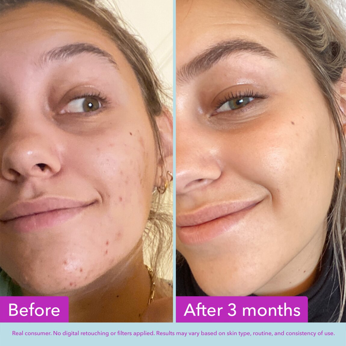 niacinamide-brightening-toner-g3 zb_p.jpg