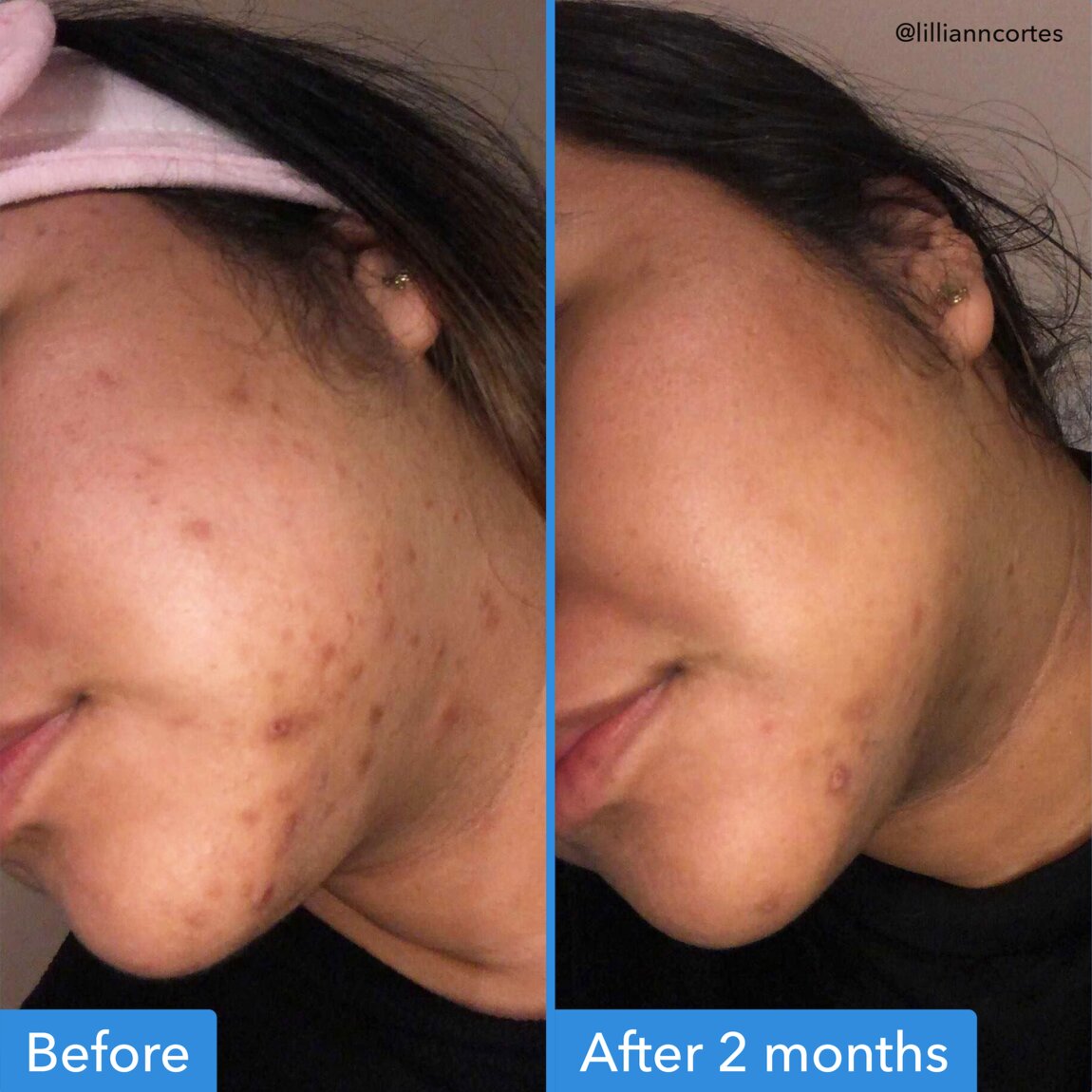 discoloration-correcting-serum-r0 zb_p.jpg